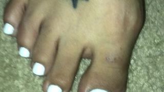 Белые пальцы ног синди