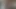 Lizzy Yum VR August 2025 Dilating #6