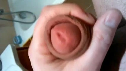 Penis