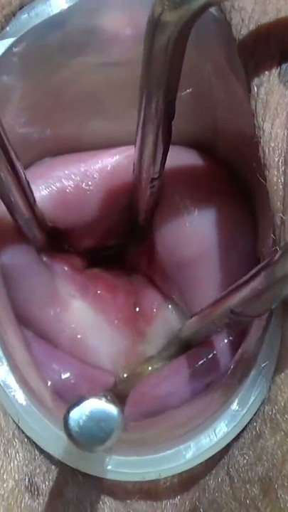 Maya Simons OPENING HER CERVIX (EXTREME) | Clip 1