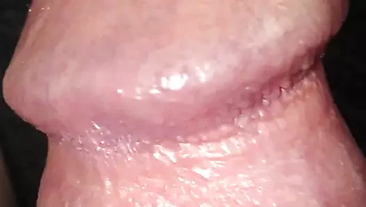 cbt20
