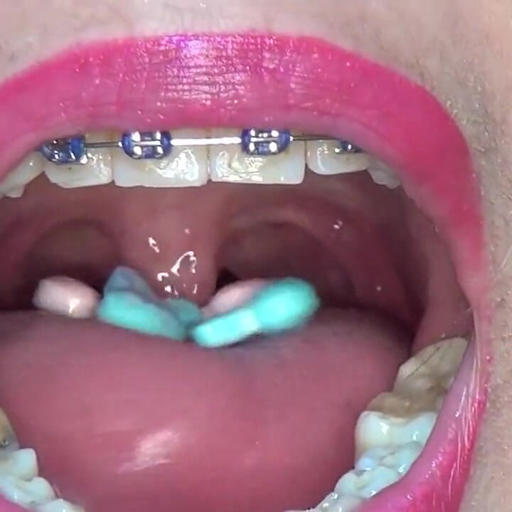 Playing and Swallowing a Candy-filled Condom in the Shape of a Rabbit
