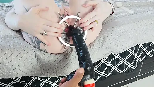 ANAL DILATION MAKES MY ASS FOLDS BURST