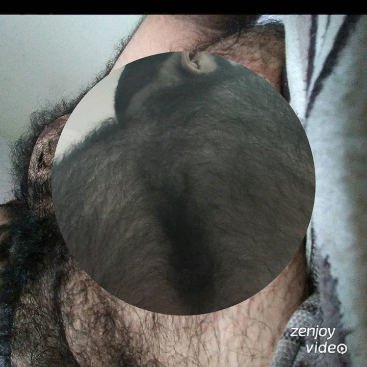 Hairy men