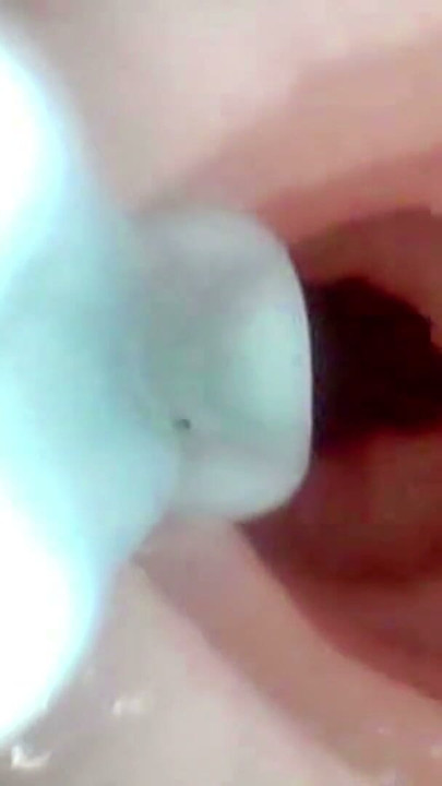 Examen approfondi de la cavité orale et anale de Lopuza93 à l’aide d’une caméra endoscopique. | Clip 3