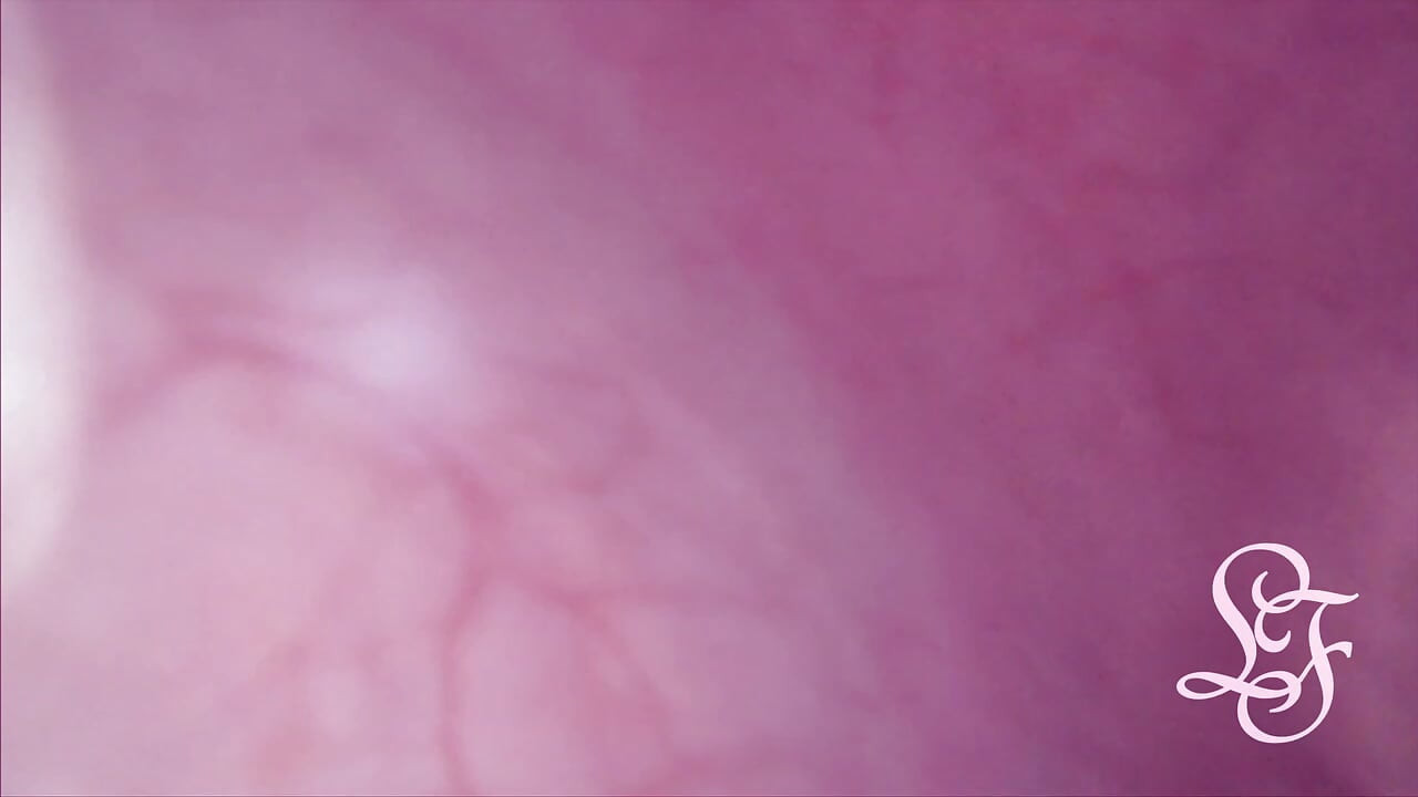 Bulge INSIDE my Bladder from Anal