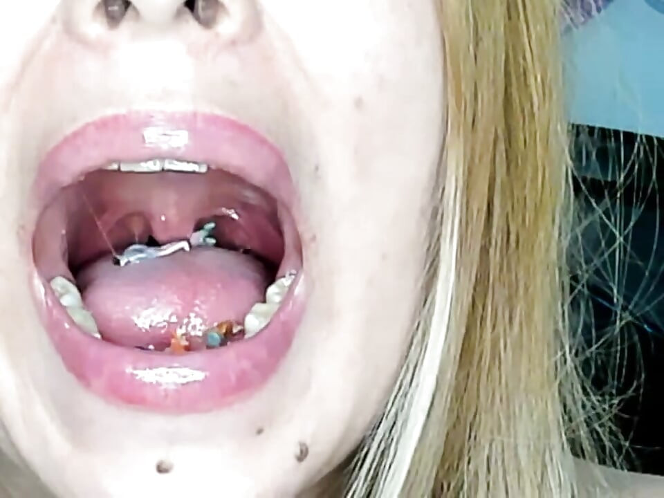 Endoscopie!! Reuzes slikte tegelijkertijd 25 leden in