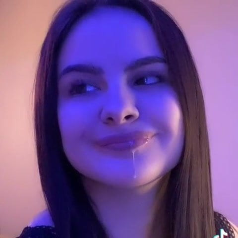 Zahnbleaching2