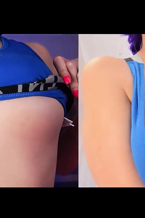 Huge Boob Bazongas  Before and After