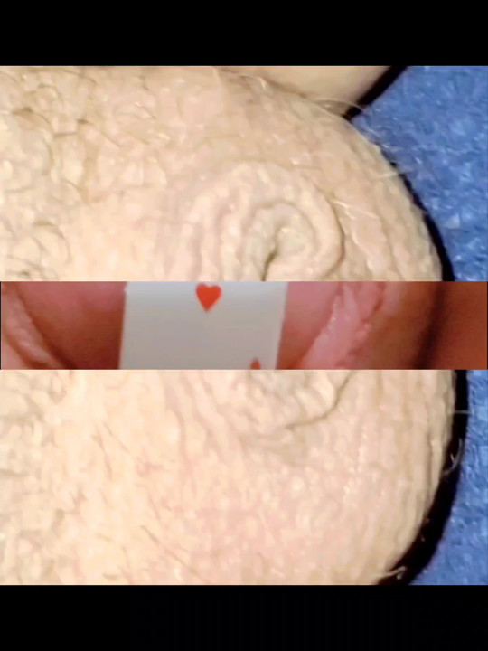 Lee Przybylowicz can go from nothing to less than nothing in seconds ....Tiny nub penis shrinks to inverted very quickly