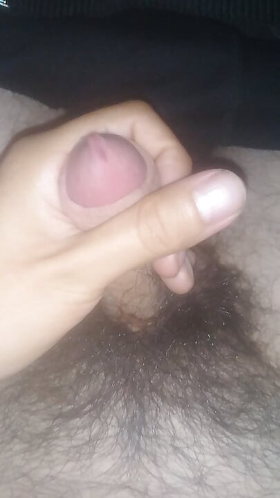 귀두가 흔들려요