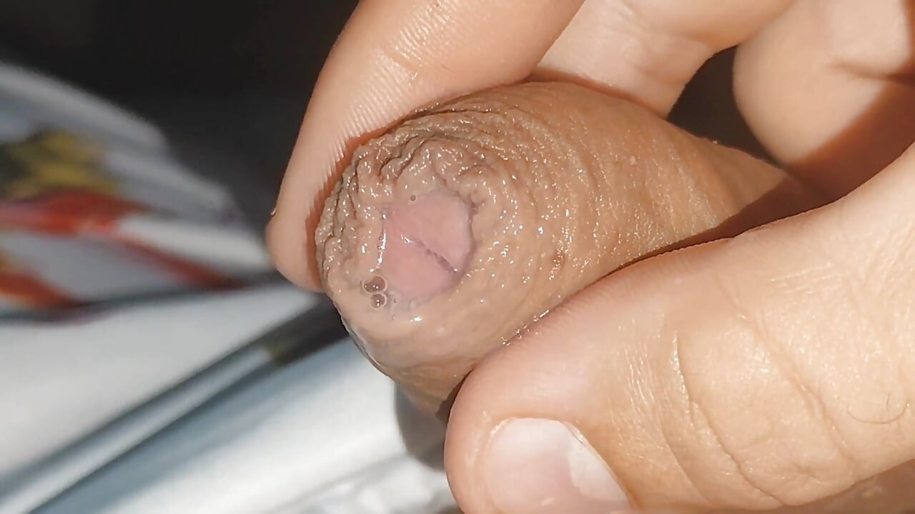 Curioso Close up De Pré Cum Na Fimose Flácida.