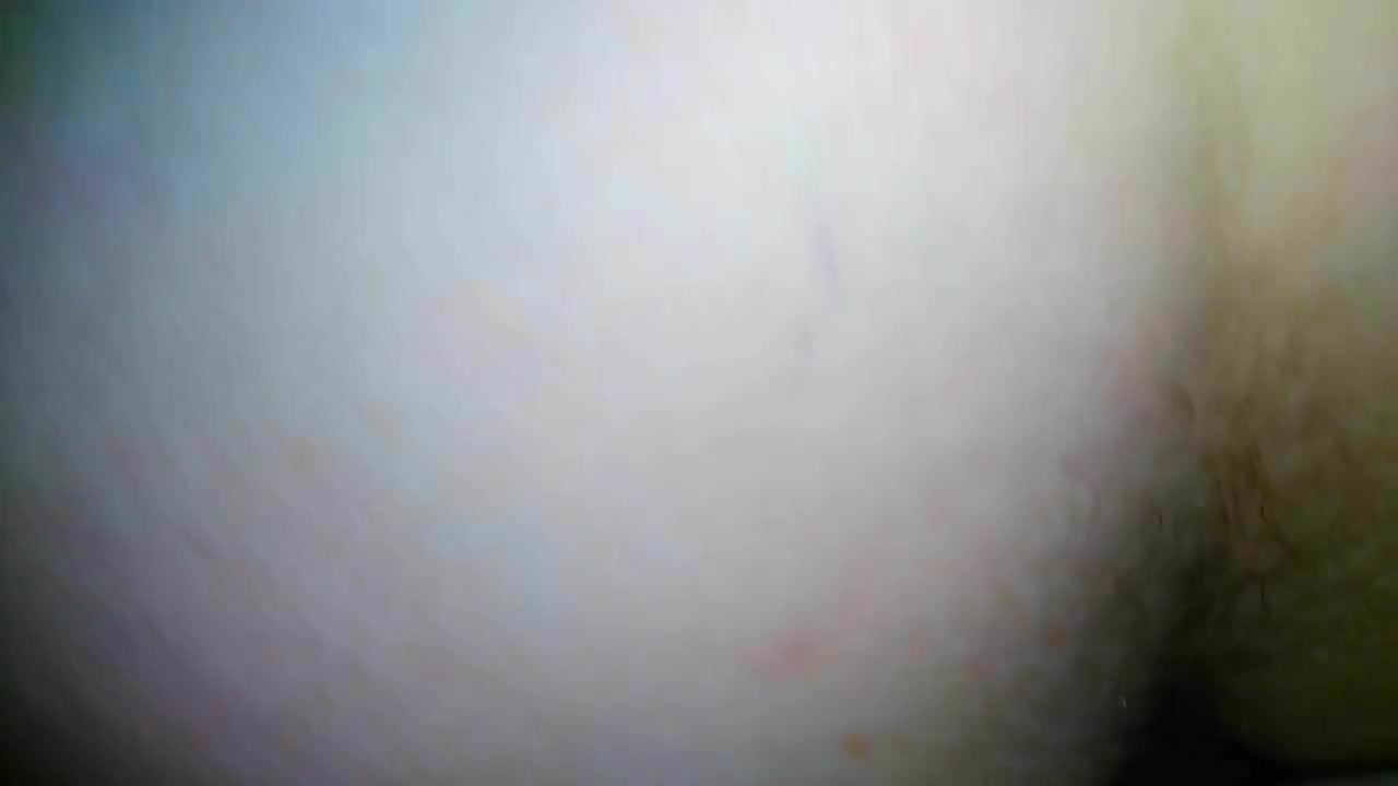 anal amat 2