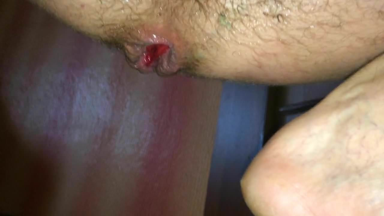 Anal plug