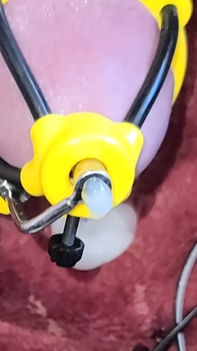 New estim accessory HFO