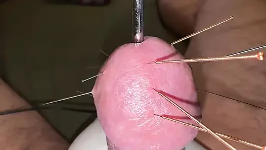 Akupunktur - Orgazm!
