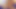 ハゲの頭の女性