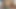 My Torn Anal. Cumming In My Ass