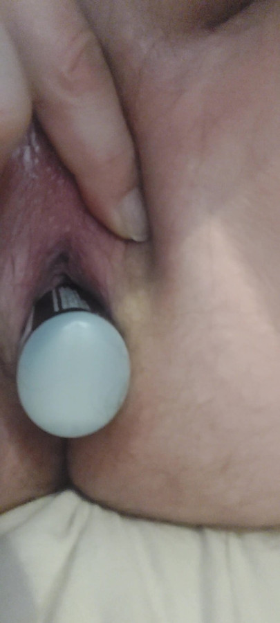 Excitations anal