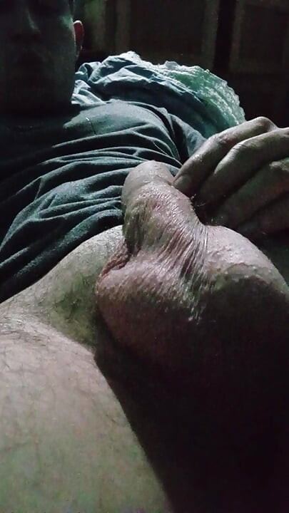 Big and painful eggs