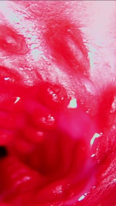 Känslomässigt ögonblick från "Saftiga vackra fittor squelches inuti ASMR närbild inuti anusen"
