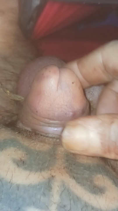 Bölünmüş kafa ve toplar