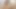 Lizzy Yum - Just DILATING #2 Post-op Orgasm Pussy Clit Masturbation Teasing Orgasm