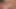 Teaser, FTM pussy