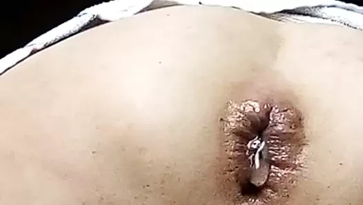 Anal abuse!