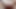 Gaping Hairy Sexy Anus and Lots of Farting