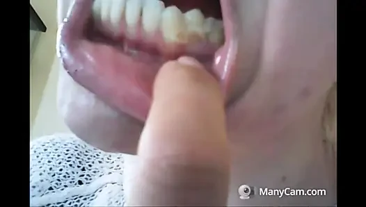 Chantal'ın dişleri çürümüş ve siyah dökülüyor