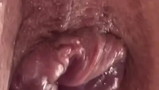 Extreme Anal Vacuum Pump Training 2025