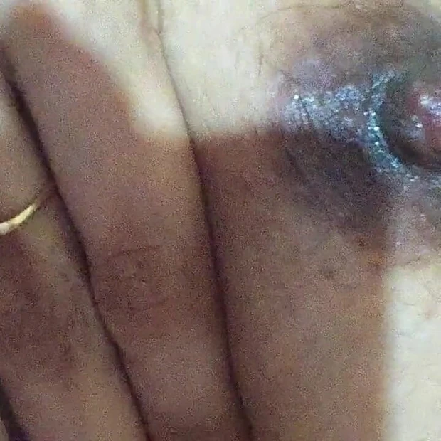 Fuck Me