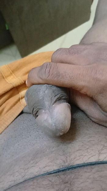 All anal