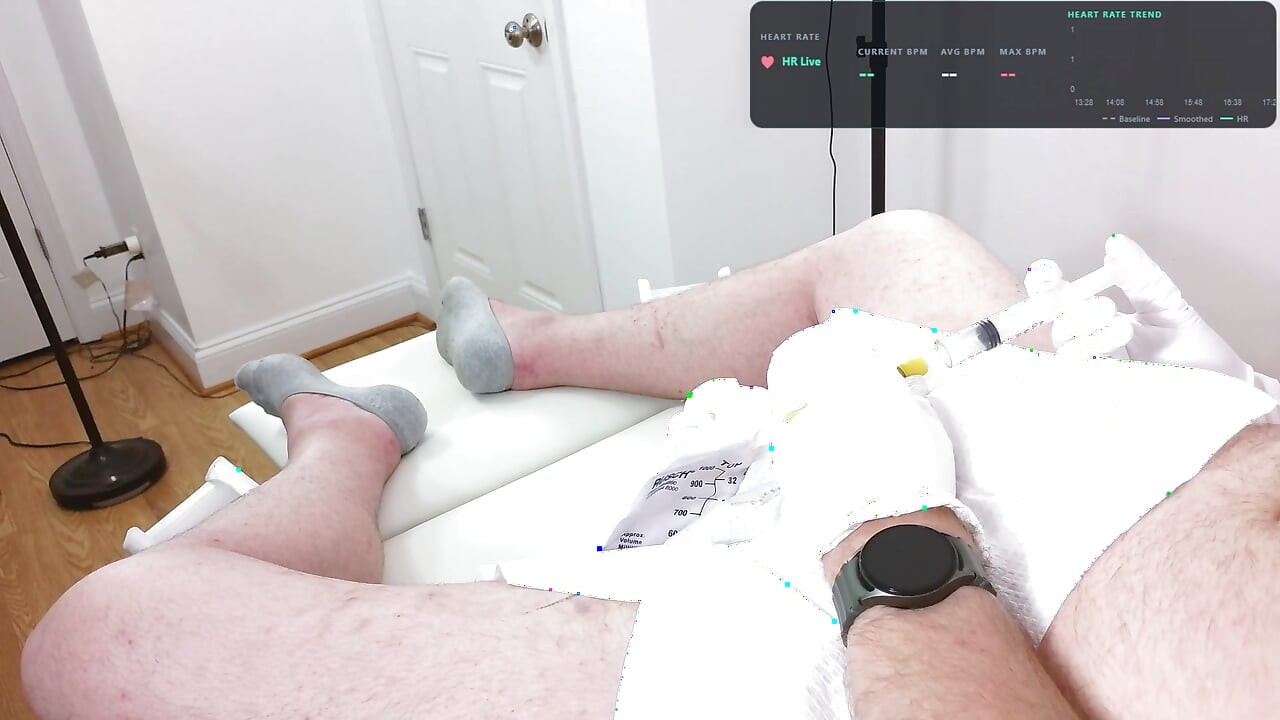 Zen 20 French Foley catheter insertion