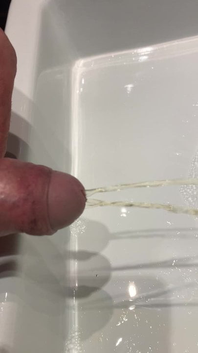 Pee