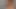 Der Muskel explodiert - Teil 1