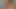 Der Muskel explodiert - Teil 1