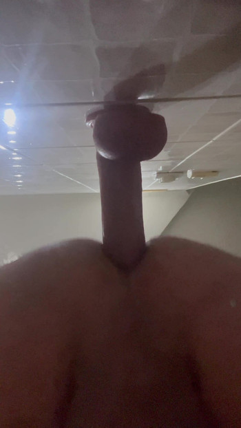 anal