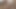 Lizzy Yum July 2023 JUST my VIBRATOR Post-Op Orgasm Pussy Clit Masturbation Teasing Orgasm