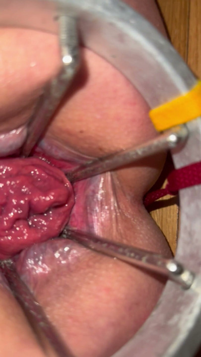 Anal expander fully open showing off rose