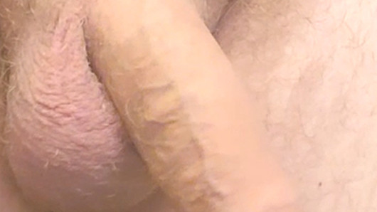 Precum and foreskin