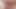 Eine große Nadel in meinen Eiern und 10 kleinere.