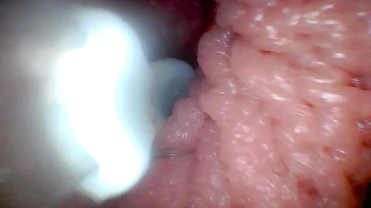 Let’s take a peek into my juicy pussy together (endoscope camera)