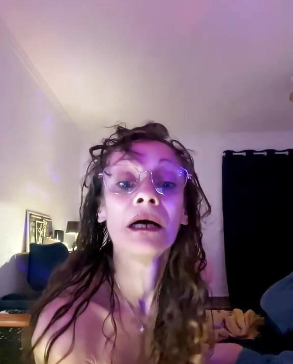 Dylatacja