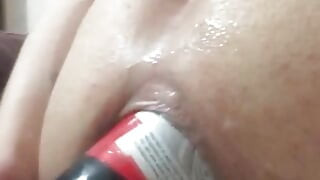 Komplikasi ternganga dubur