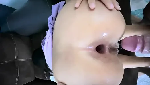 A Lil Anal
