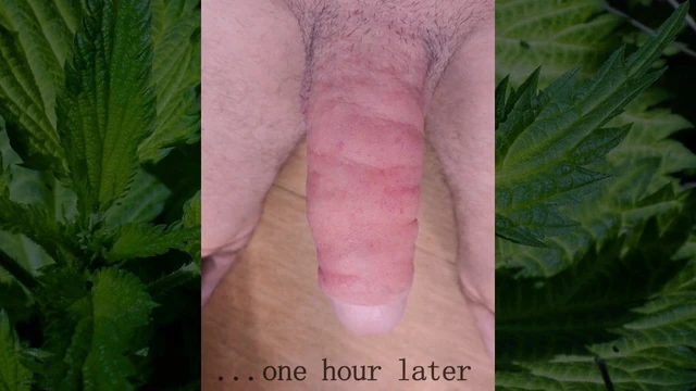 Nettle cock torture