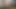 Bold and explosive anal fisting from a young bi couple who exposes all their charms in close-up and in good quality.