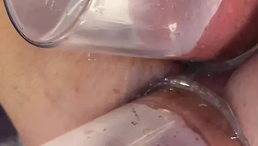 Extreme Close up Double Vacuum Pumping Ass and Pussy